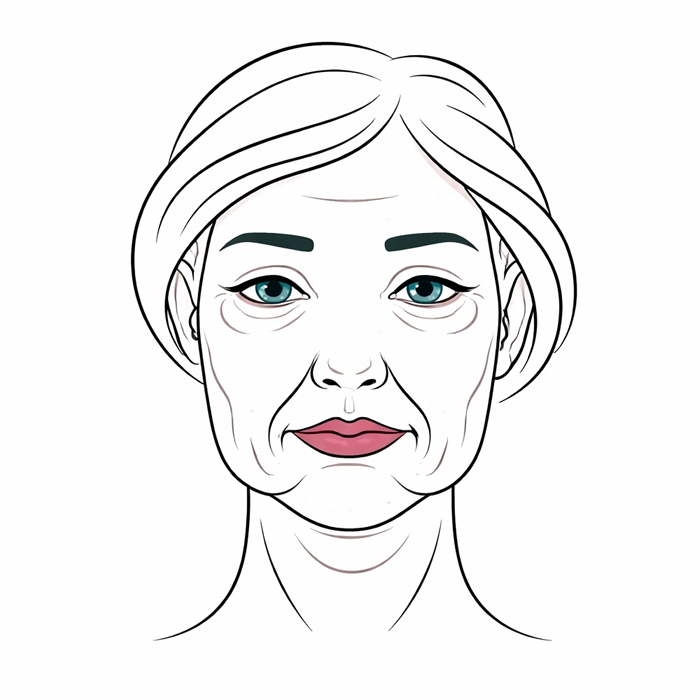 Деформационный морфотип